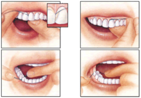 Instructions on flossing